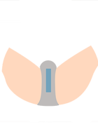 Iライン