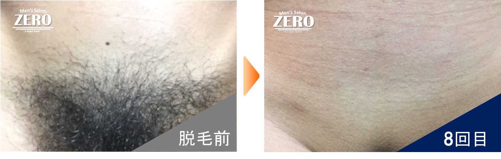 ビフォーアフター