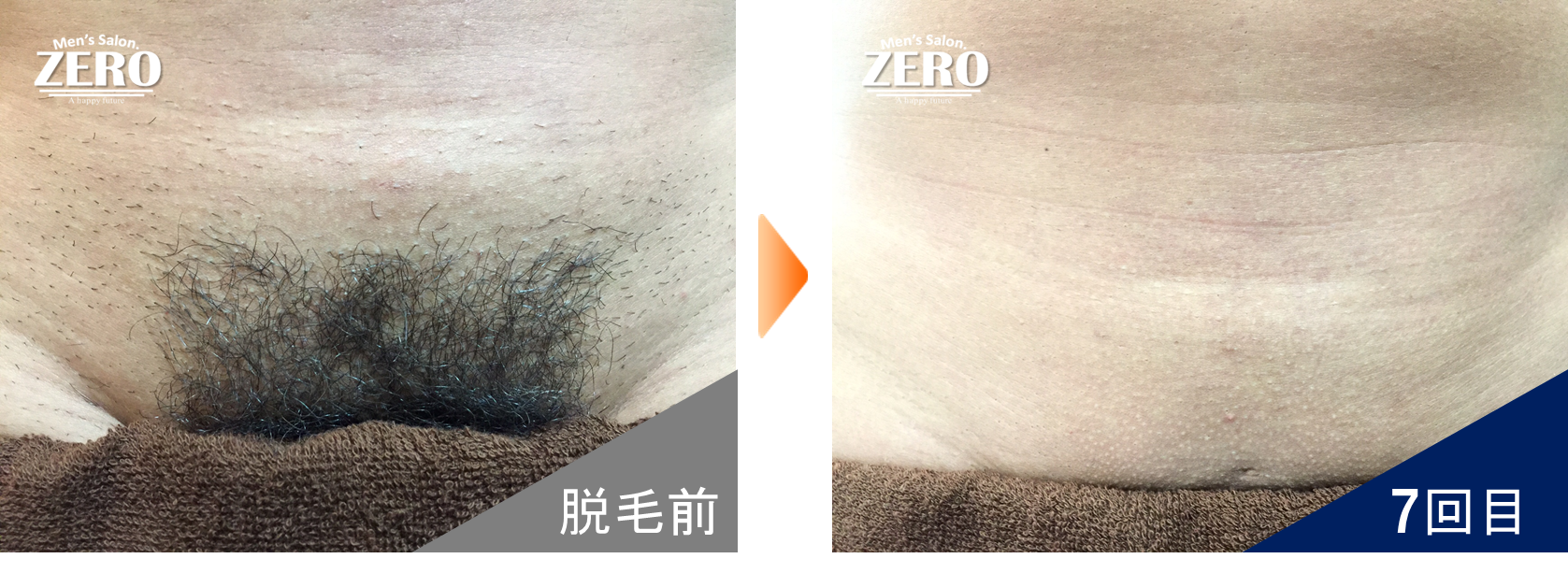 ビフォーアフター