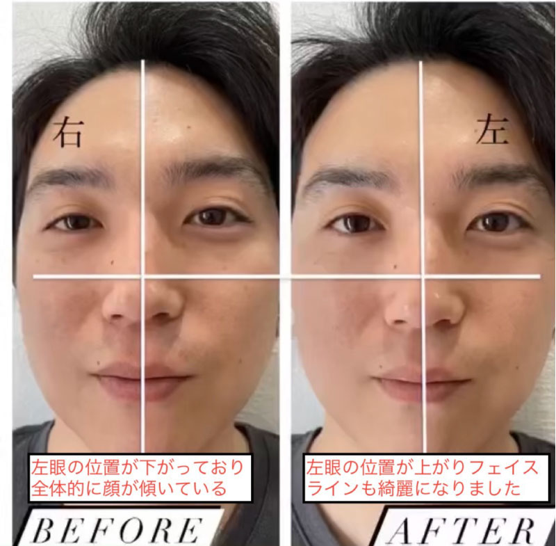 ビフォーアフター
