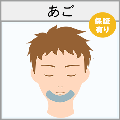あごの脱毛範囲画像