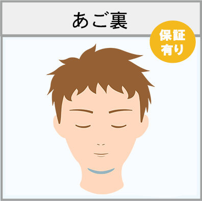 あご裏の脱毛範囲画像