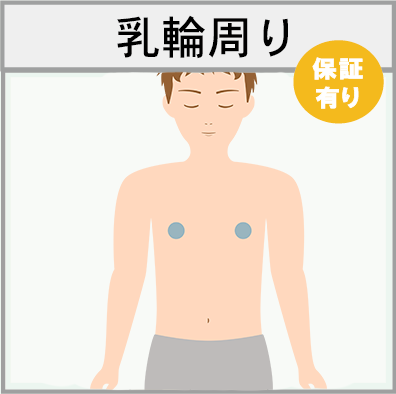 乳輪回りの脱毛範囲画像