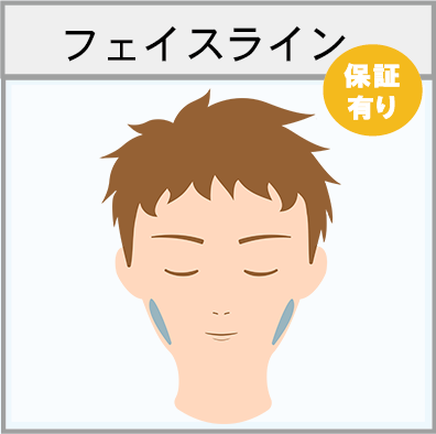 フェイスラインの脱毛範囲画像