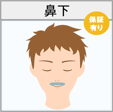鼻下の脱毛範囲画像
