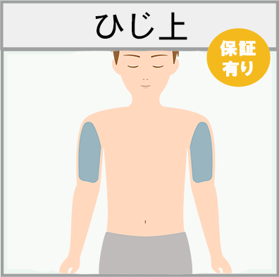 ひじ上の脱毛範囲画像