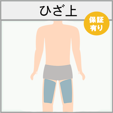 ひざ上の脱毛範囲画像