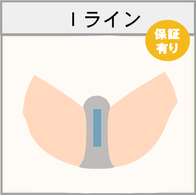 Iラインの脱毛範囲画像
