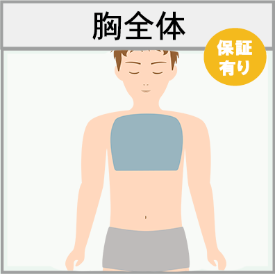 胸全体の脱毛範囲画像