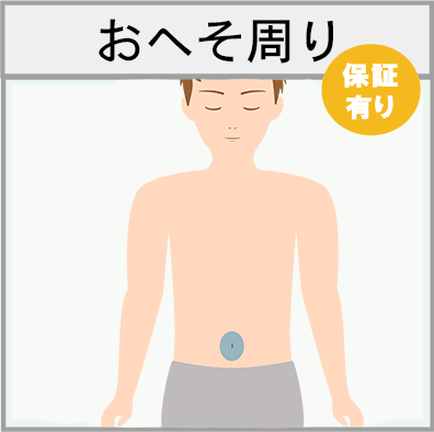 おへそまわりの脱毛範囲画像