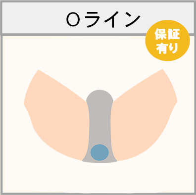 Oラインの脱毛範囲画像