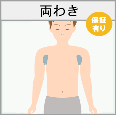 両わきの脱毛範囲画像