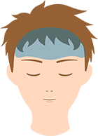 おでこ