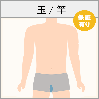 玉/竿の脱毛範囲画像