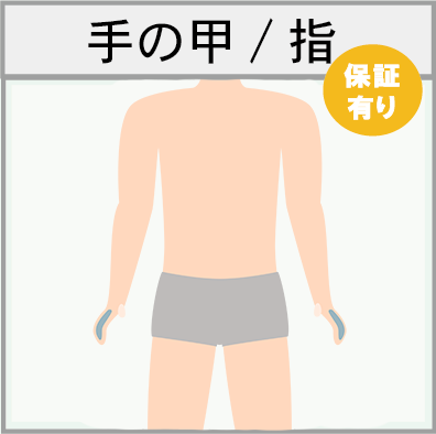 手の甲/指の脱毛範囲画像