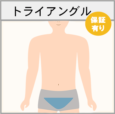 トライアングルの脱毛範囲画像