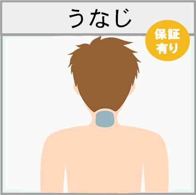 うなじの脱毛範囲画像