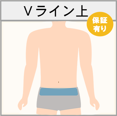 Vライン上の脱毛範囲画像