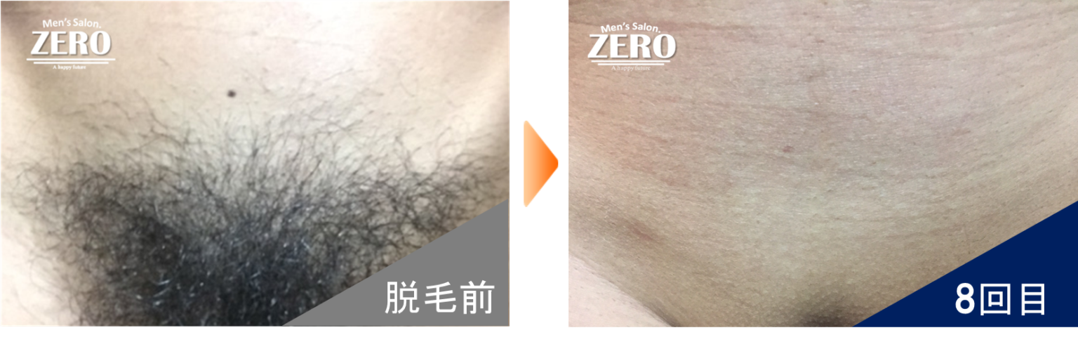 ビフォーアフター