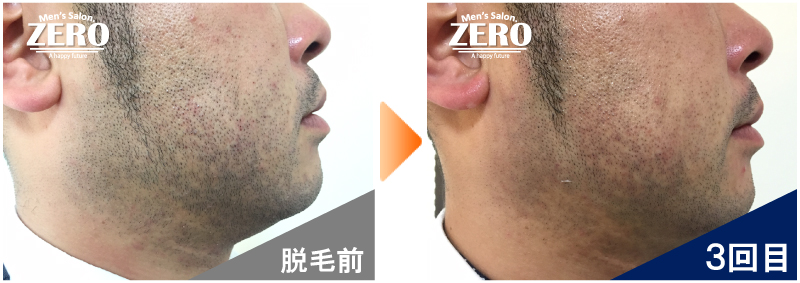 ビフォーアフター