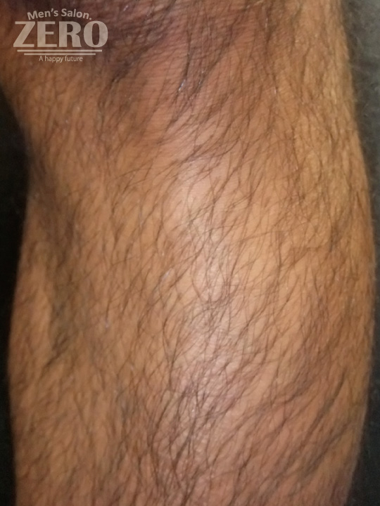 Before