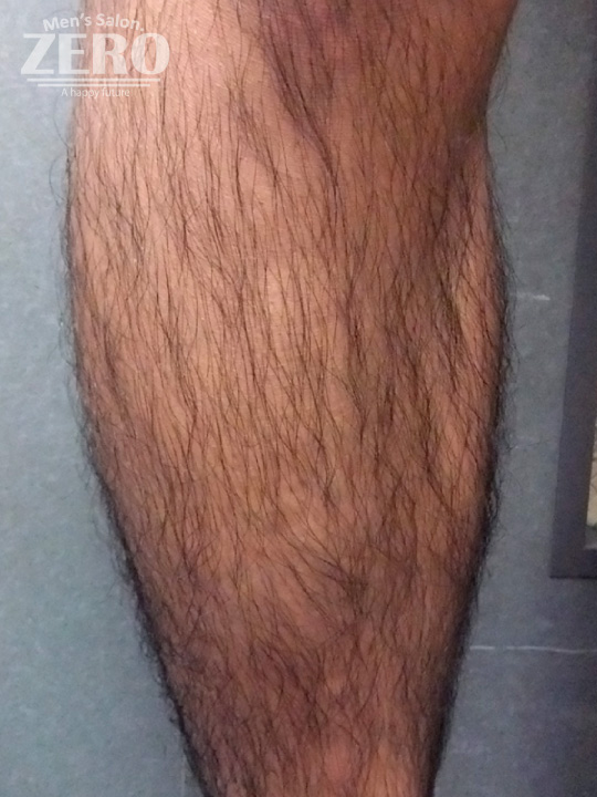 Before